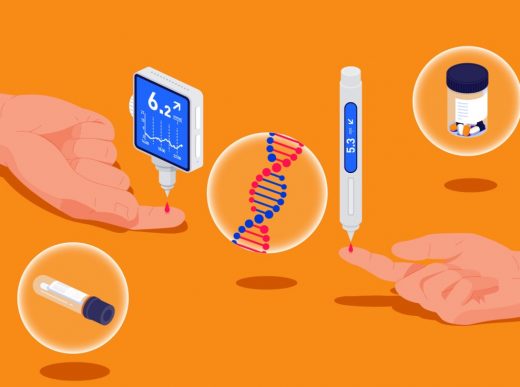 Лечение Сахарного диабета