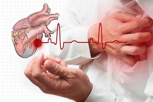 В случае сердечного приступа, у вас есть только 10 секунд, чтобы спасти свою жизнь!