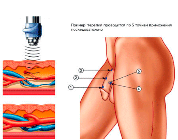 Андро-Гин терапия в Бухаре в клинике Azimed Hospital